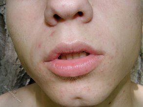 Nature boy twink showing off his massive cock outdoors