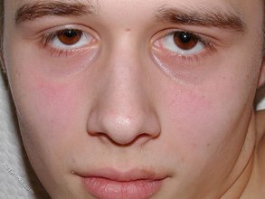 Young boy with a really hairy asshole shows it all