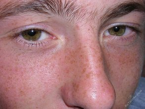 Green-eyed red-faced twink takes off his shirt