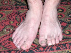Hairy cock twink posing with his legs spread wide apart