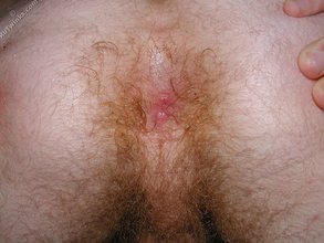 Redheaded twink and his alluring hairy asshole