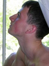 Young boy with red cheeks showing his hairy cheeks on cam